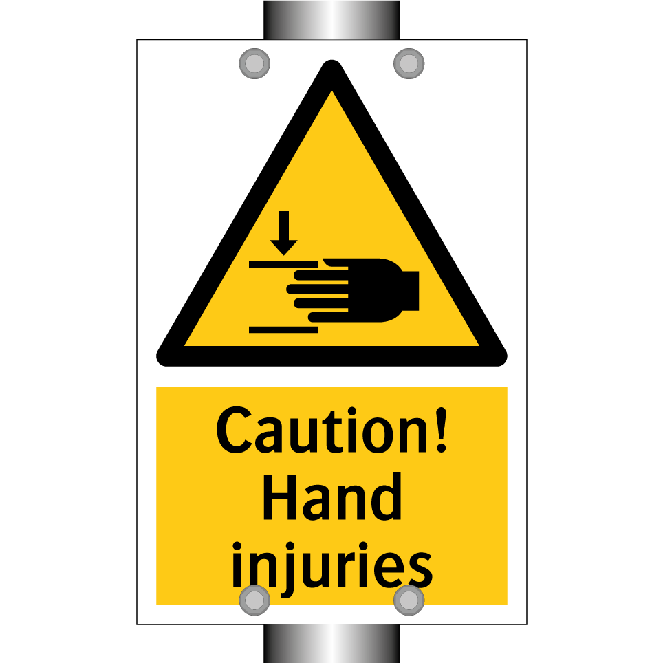 Caution! Hand injuries